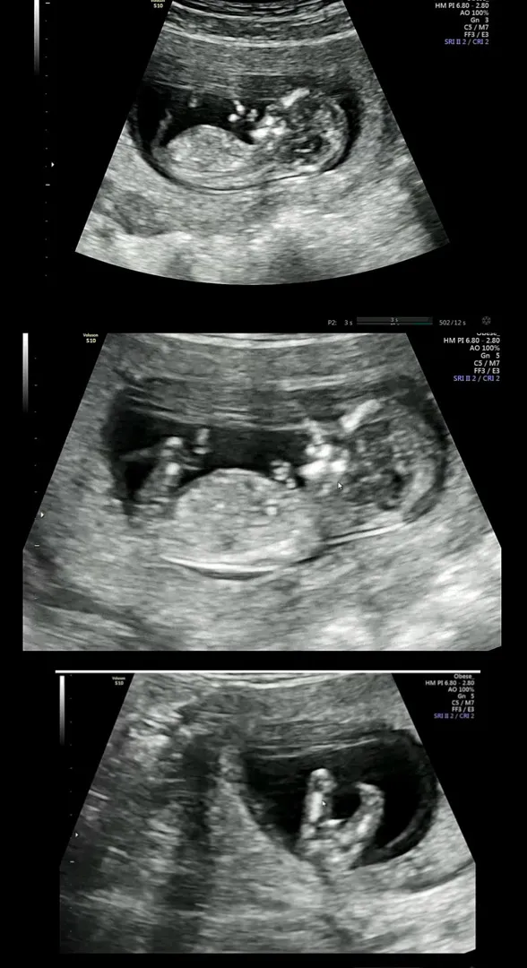 12주2일 각도법 문의드립니다아💖❤️