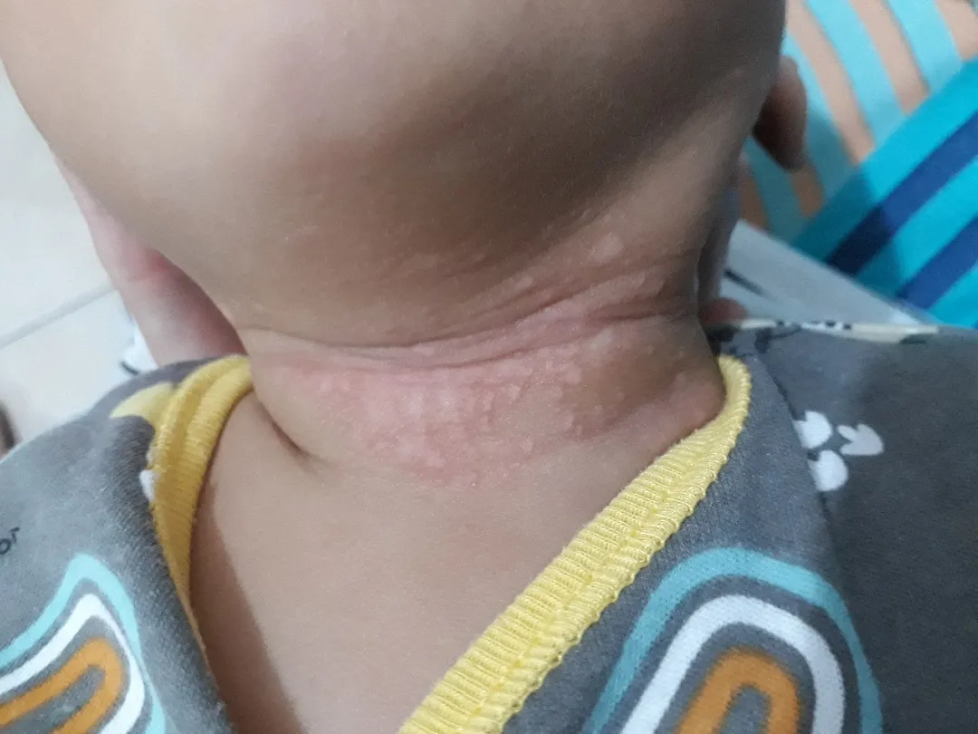 Leher bayi