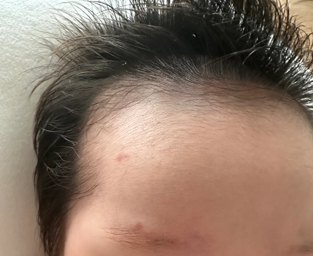 피부에 이거 뭘까요?