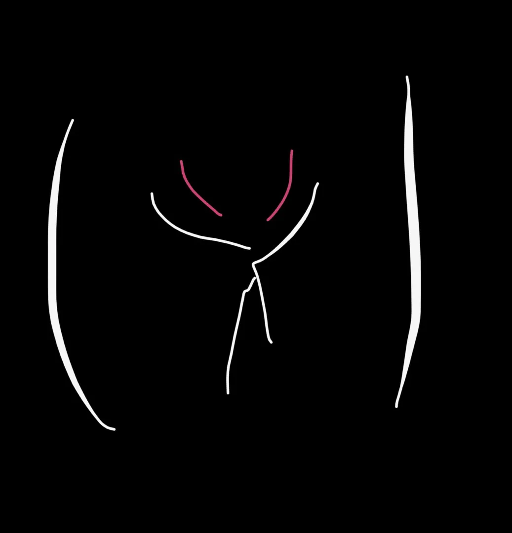 치골통? Y존 통증? 다들 겪으세요???