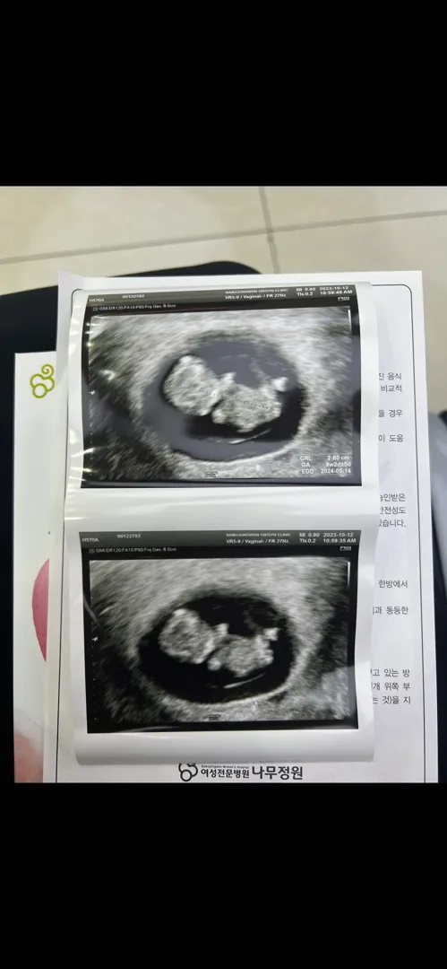 9주차 찰떡이 하리보