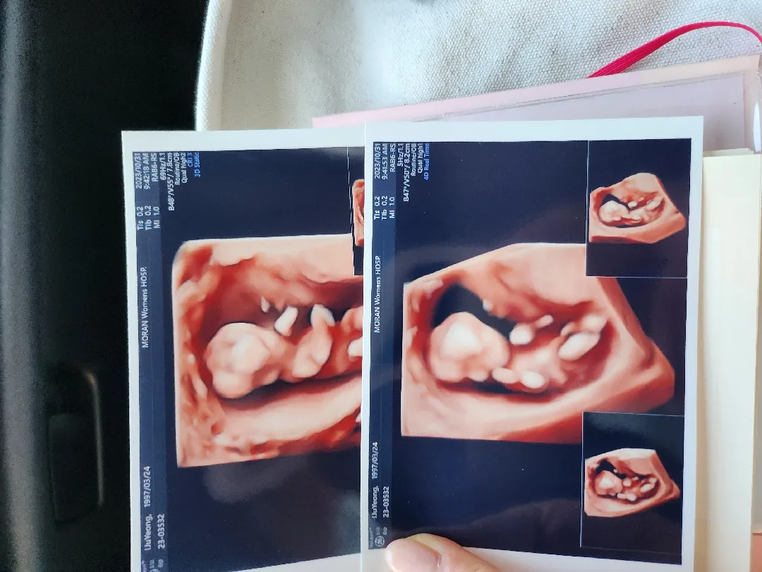 10월 31일 1차 기형아 검사하구 왔어요ㅎ