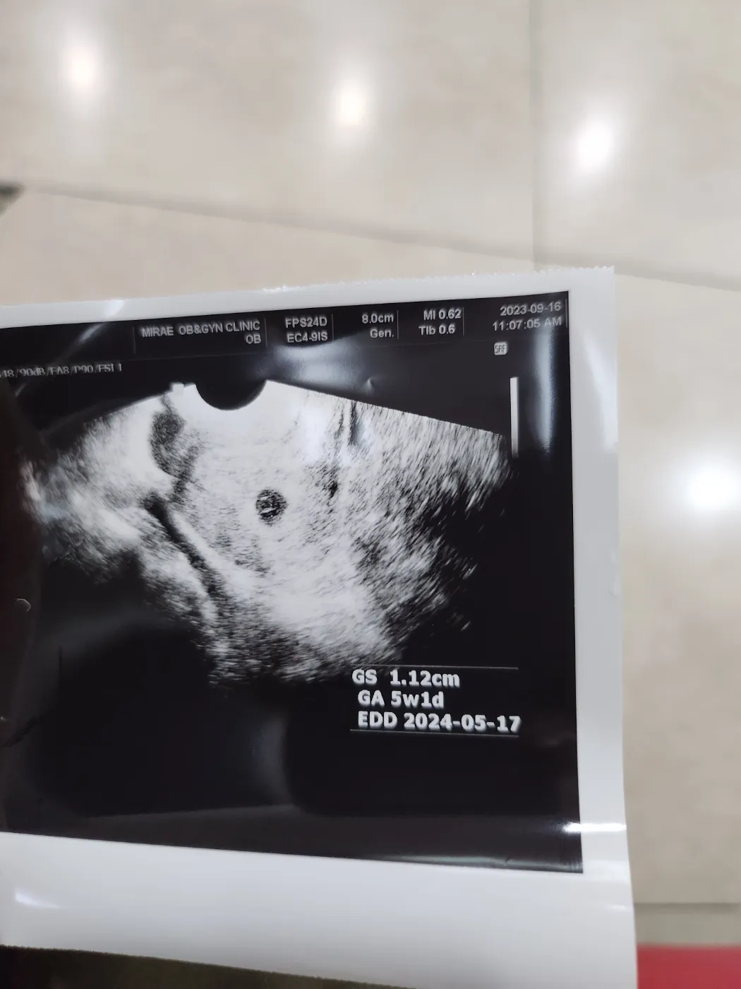임산부 넘어짐으로 인해 근처 산부인과 다녀왔어요.