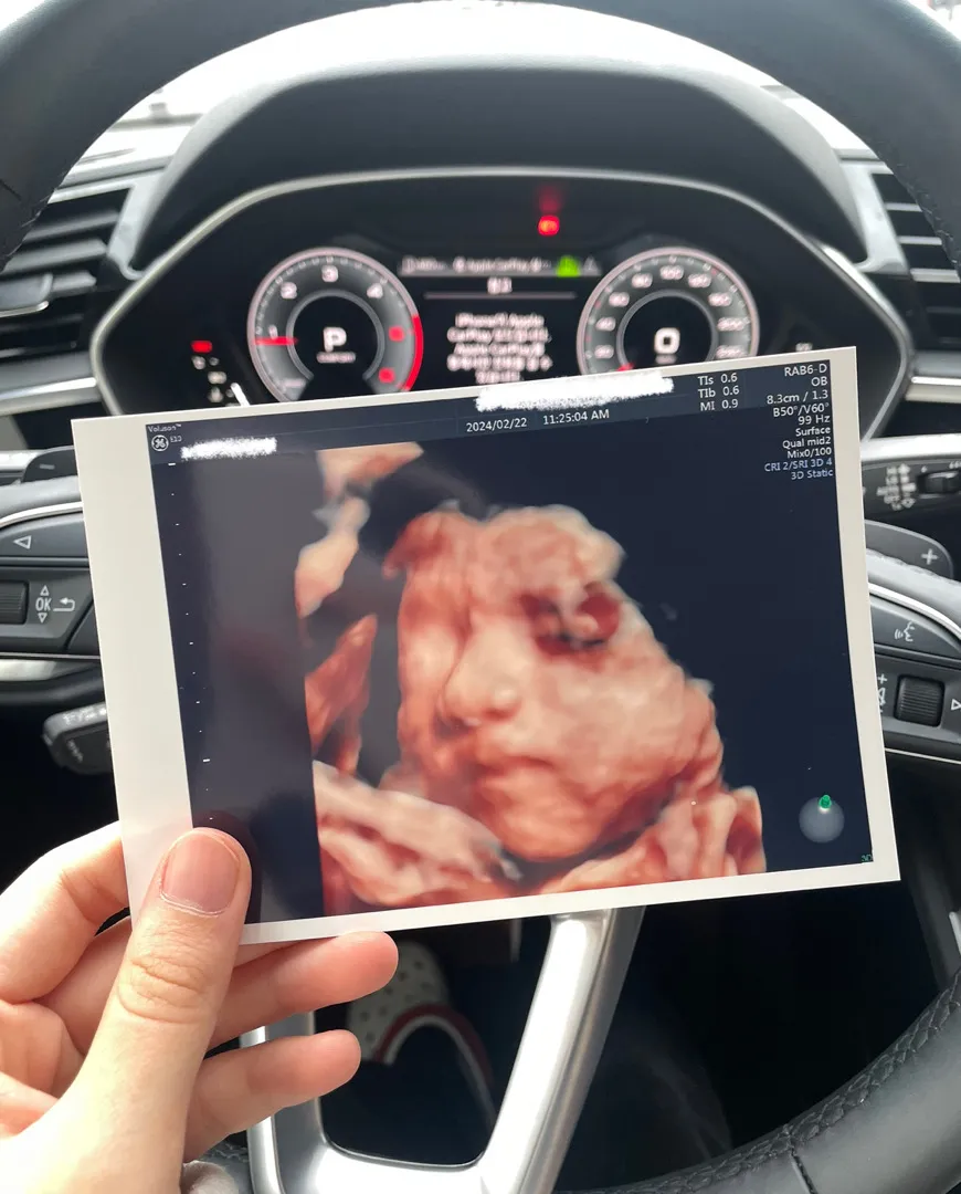 울아가 입체초음파 보고 왔어요! ! ! 👶🏻