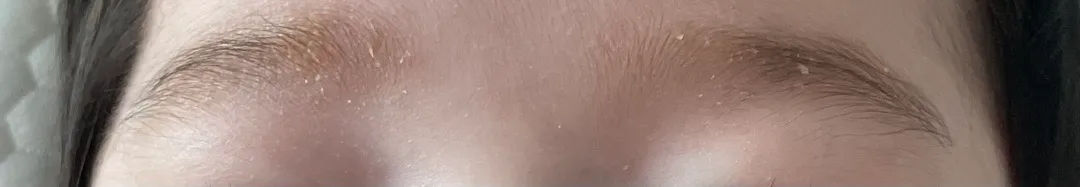 아기눈썹 