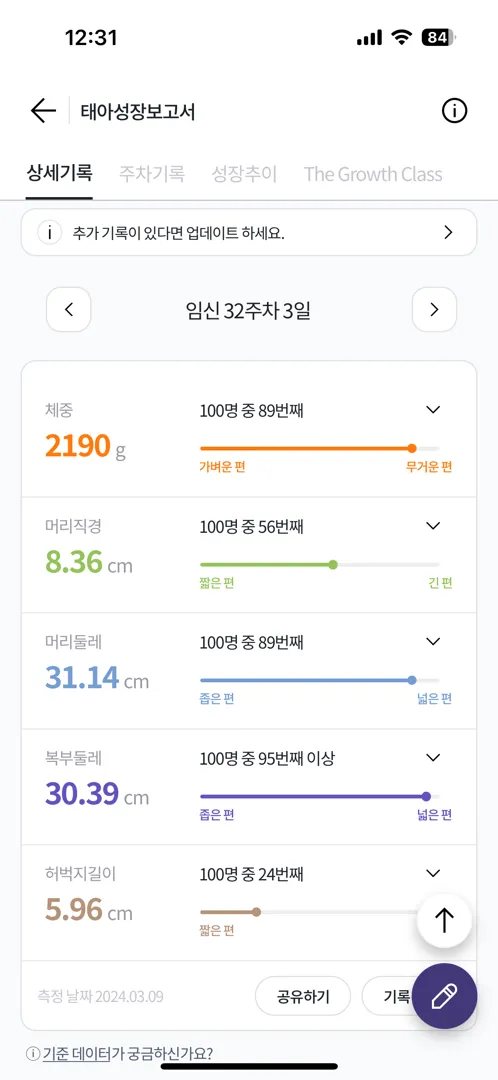 태아성장보고서ㅎㅎ