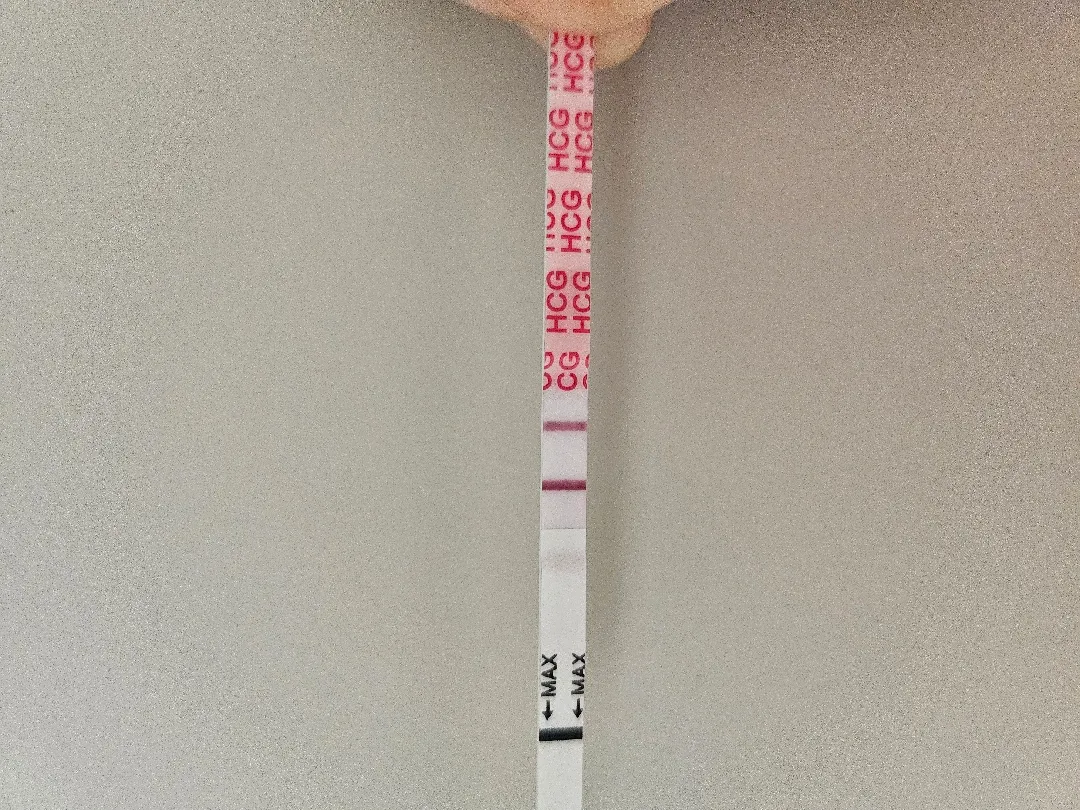 2차 피검 하면서 초음파 보고싶다고 말씀드려도 될까요 ???
