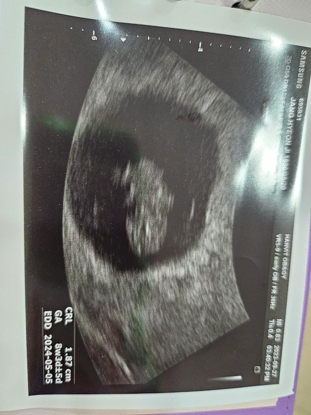 8주 3일차에 애기 보고왔어요