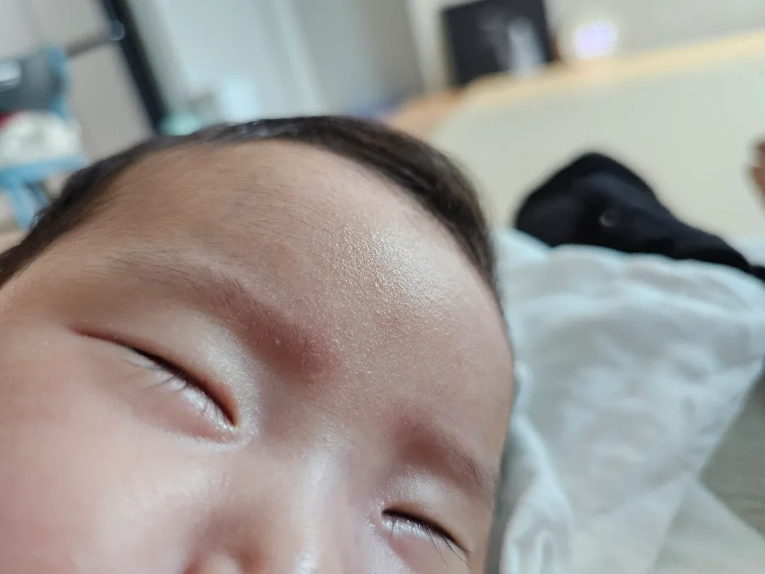 아기오돌도돌피부
