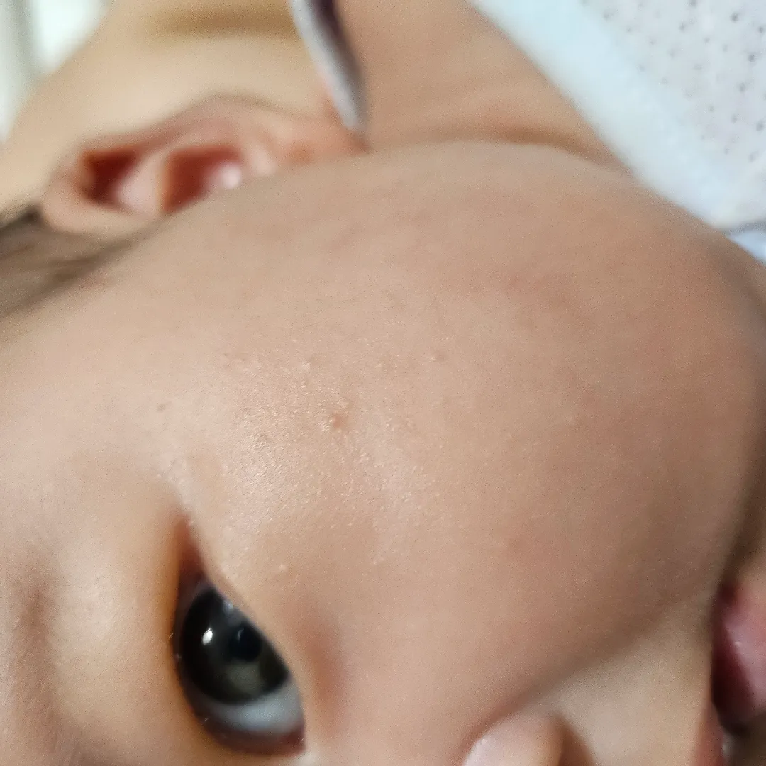 얼굴에 이게 뭘까요??😂