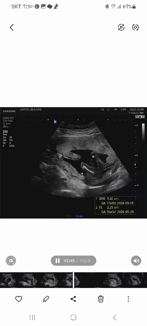 안녕하세요?ㅎ 성별이 궁금해 올립니다~