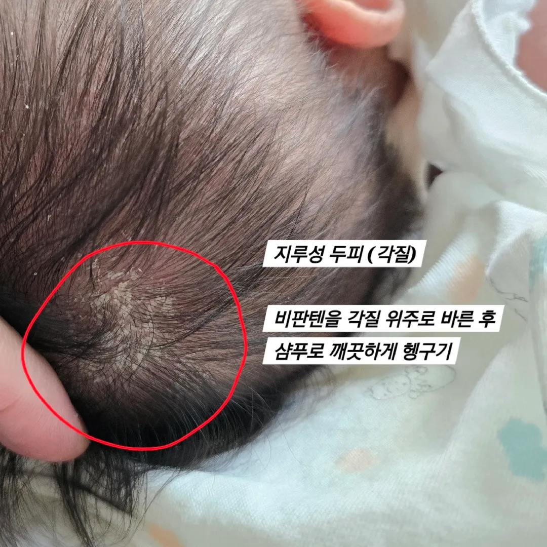 신생아 질병 총집합