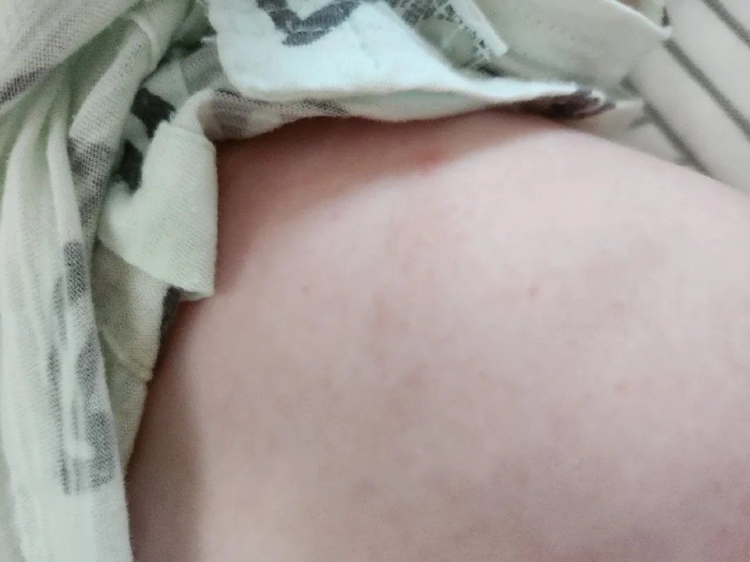 피부난게이게몰까요..?  다리는오돌토돌..  배는 빨갛게 ㅜ