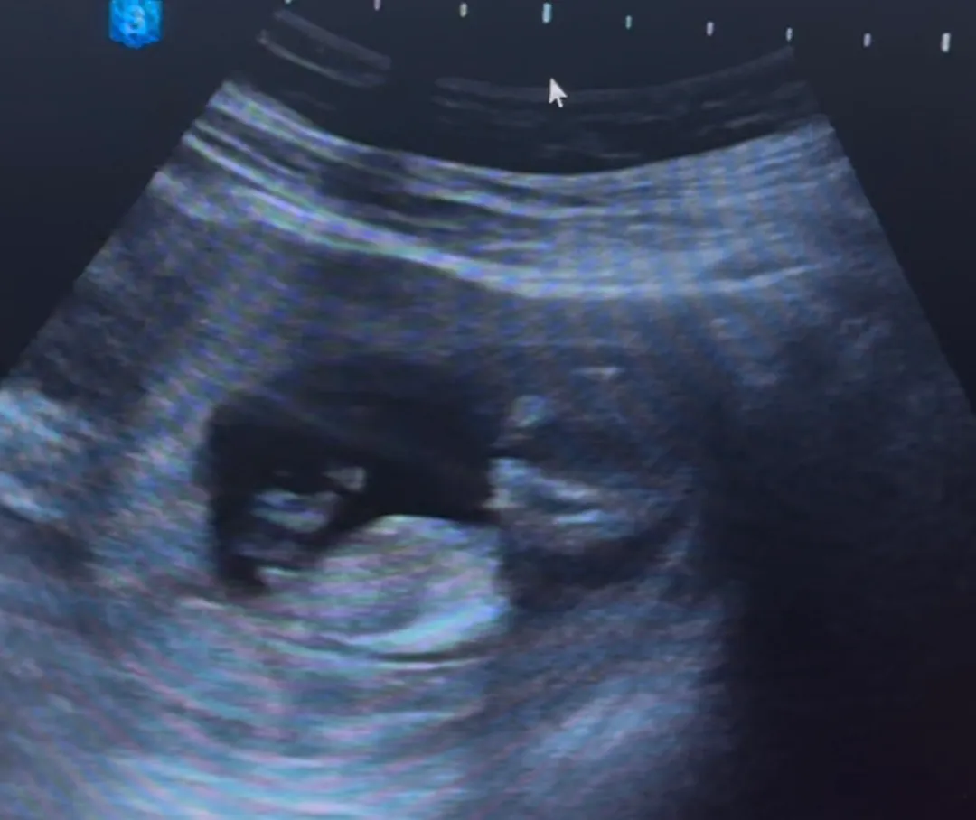 11주5일 각도법 ㅠㅠ한번만 봐주세여