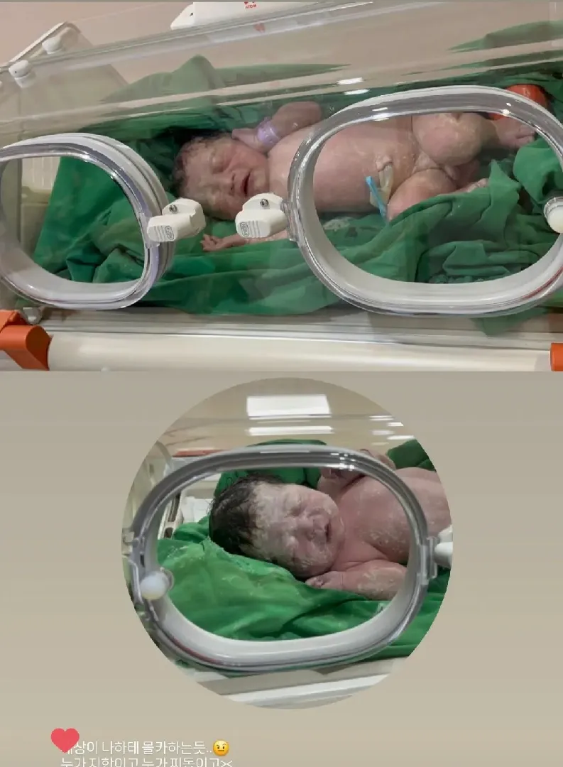 둘째 39주0일 제왕으로 뿅