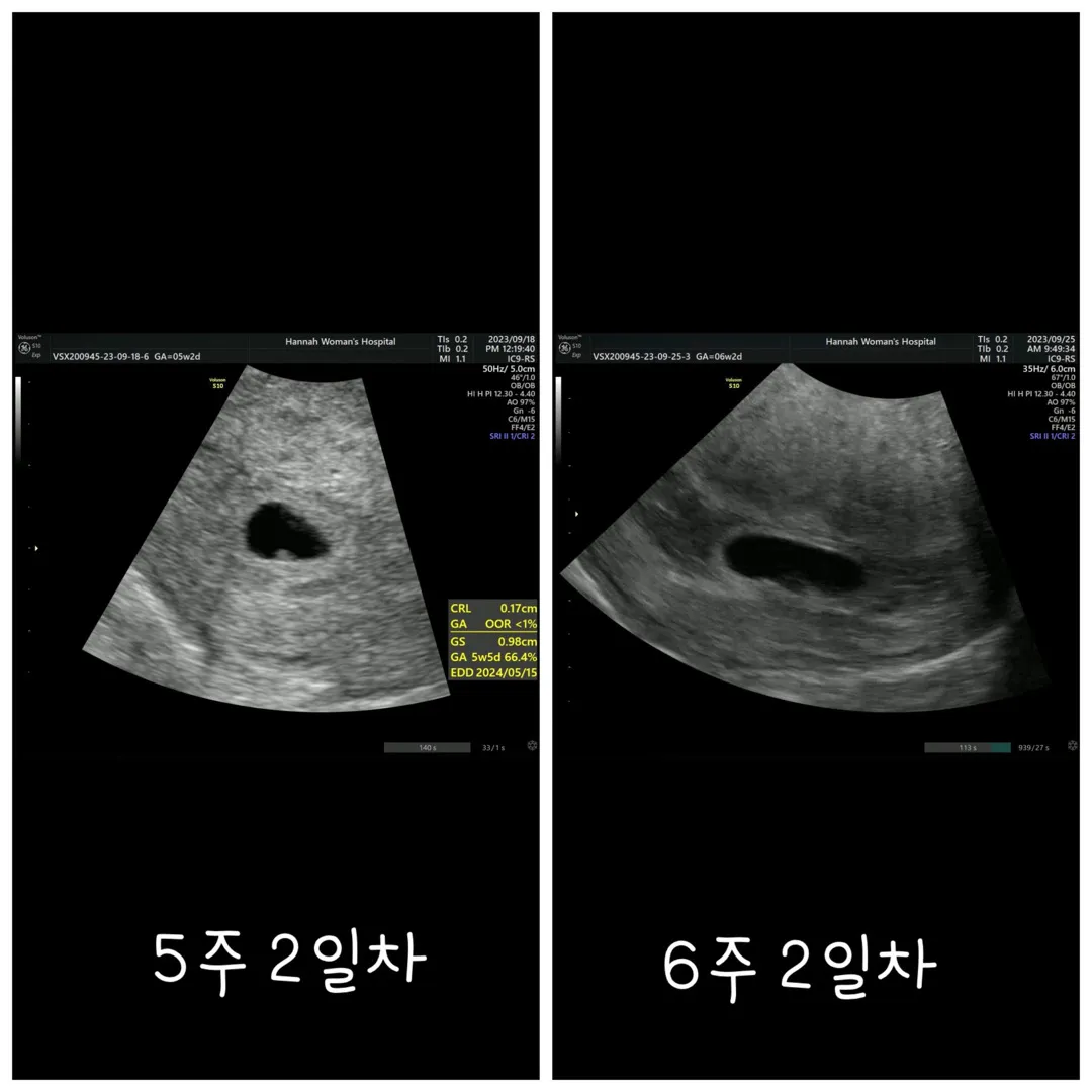 6주 2일차 고사난자라고 하는데..