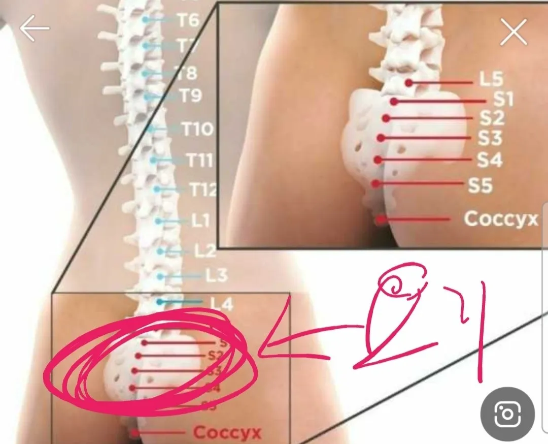 엉치뼈 돌출 있으신분?