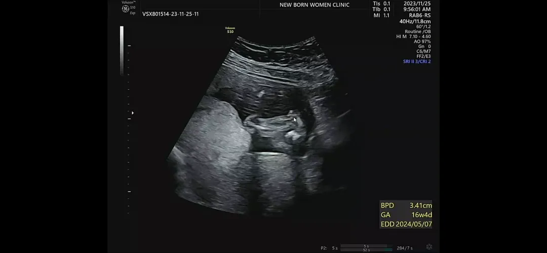 16주 0일 딸일까요~?