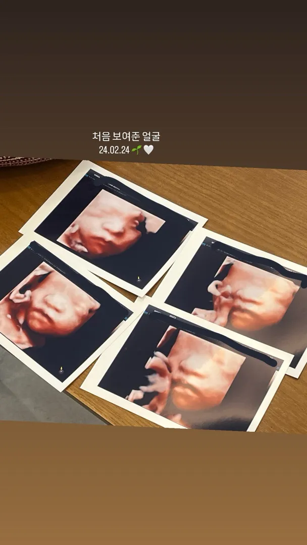 입초 보고왔어요💚