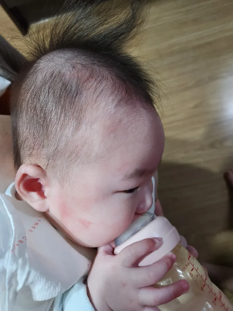 혹시 이런증상 뭔지 아시는분요.