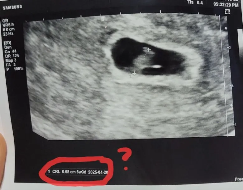 차이가 이렇게 많이 나나요??
