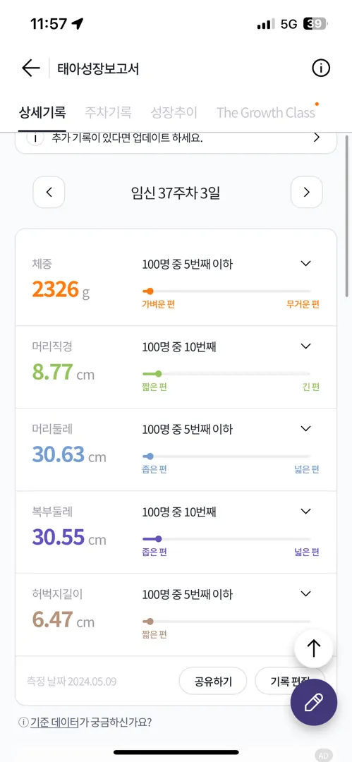 37주3일 2.3키로 작은 아기
