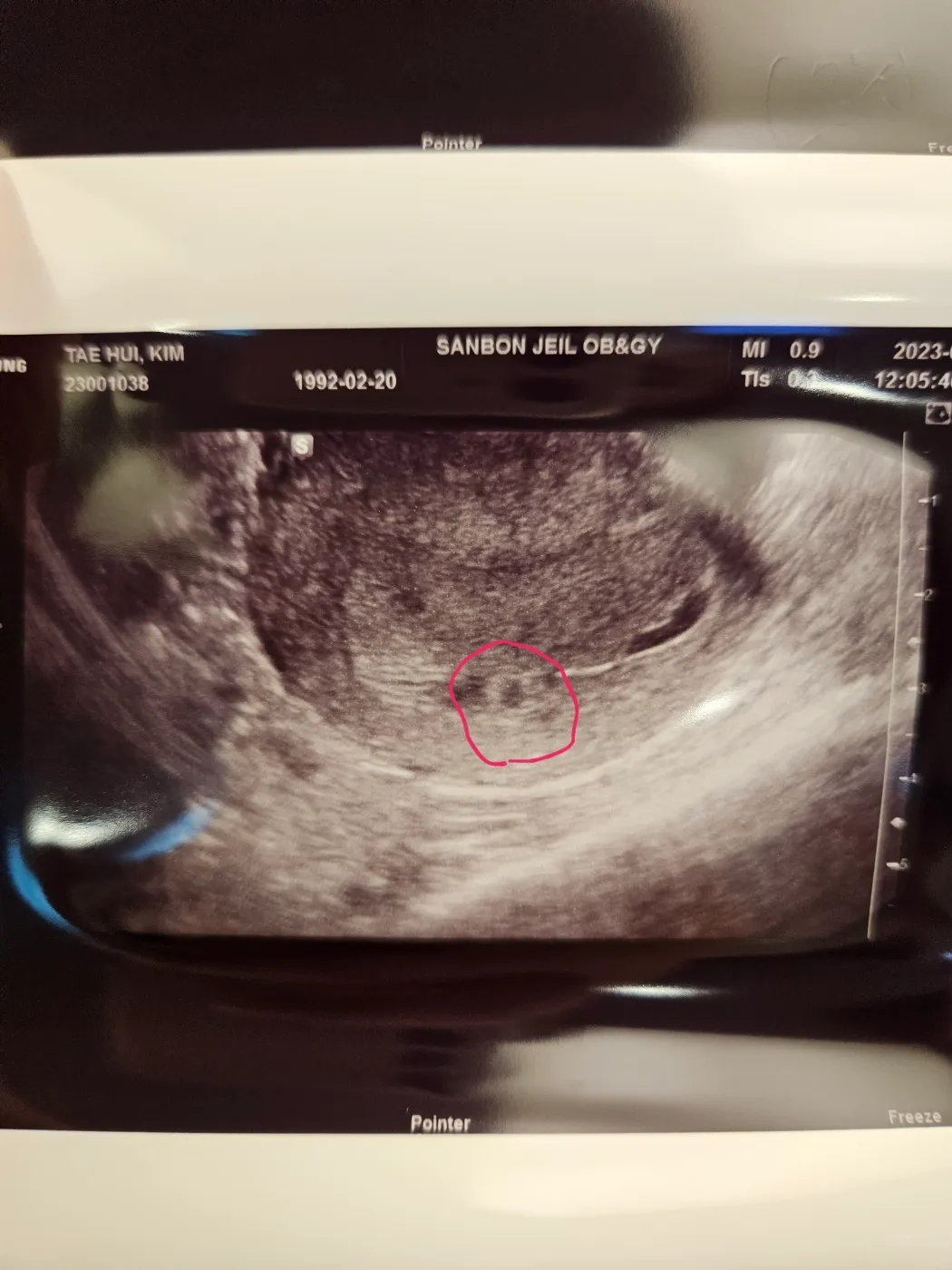 4주 6일차 아기집 보고왔어요!!