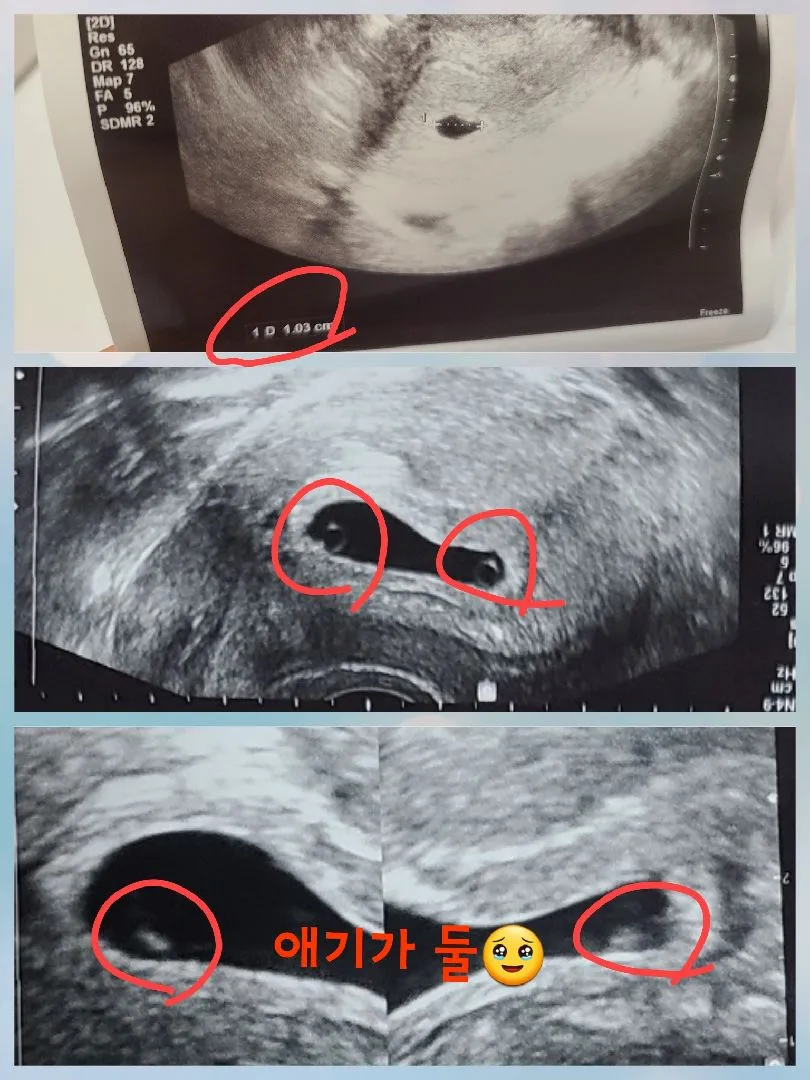 갑분 일란쌍딩이라뇨..🥹