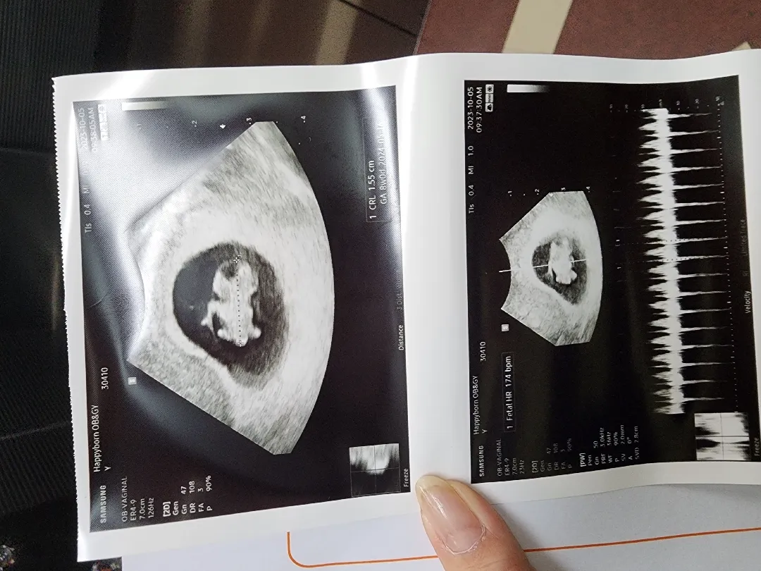 찰또기 보고왓어용ㅎㅎ