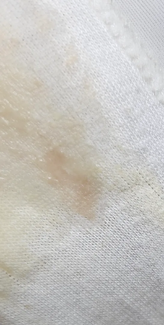이것도 이슬일까요?(사진있음 주의)