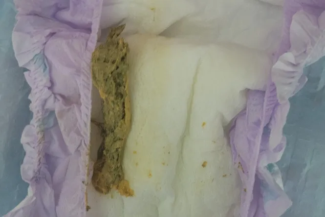 아기 변 색깔 봐주세요ㅠㅠ(사진첨부)