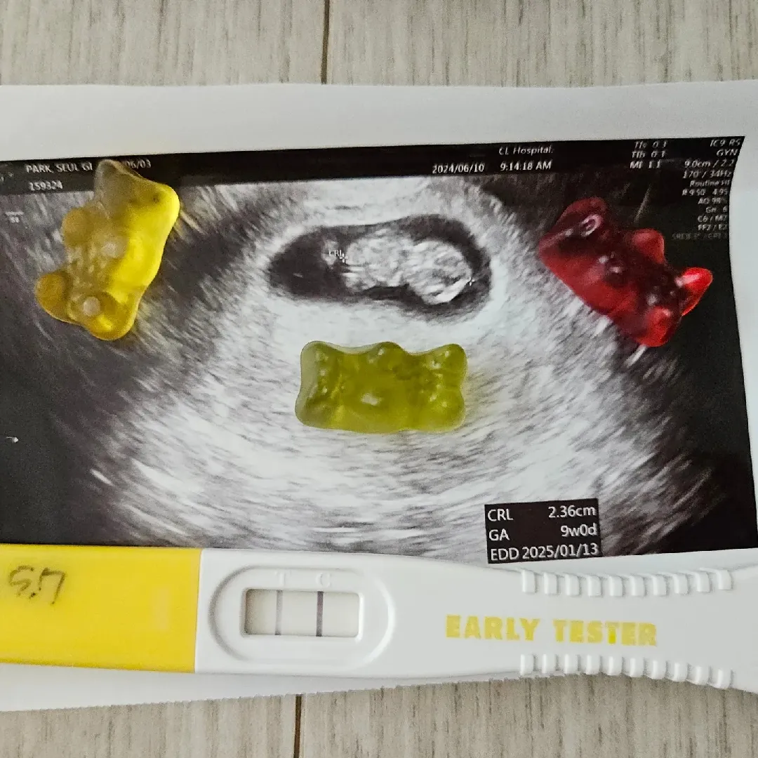 9주1일차 젤리곰 보고 난임 병원 졸업!!