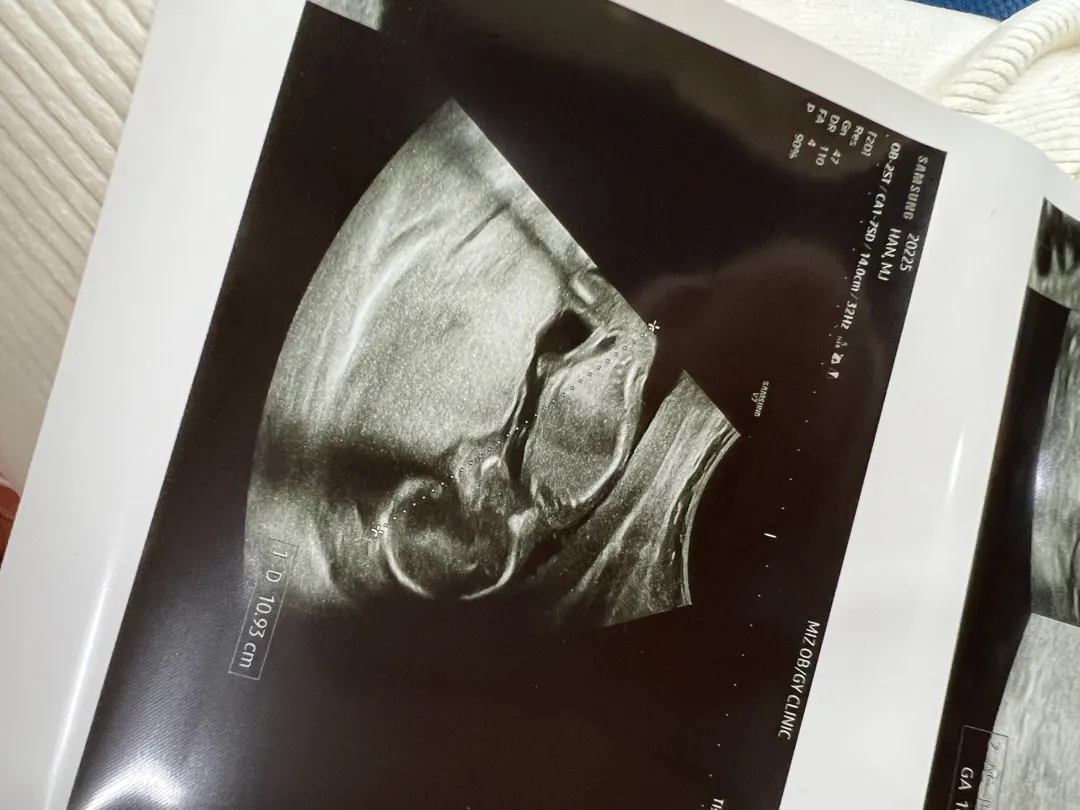 저희 아기 딸이래요 ㅠㅠ