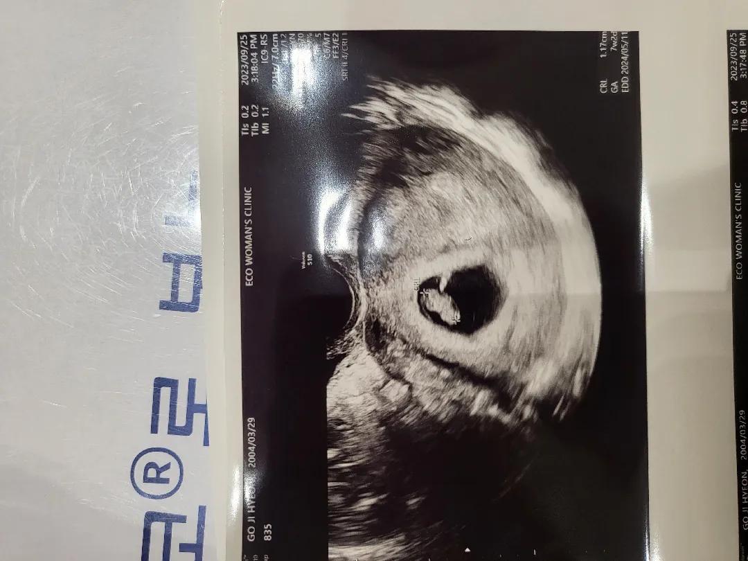 7주 6일된 초보아빠입니다
