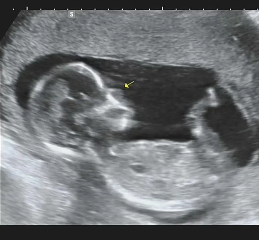 쇼둥이! 너무 이쁘다