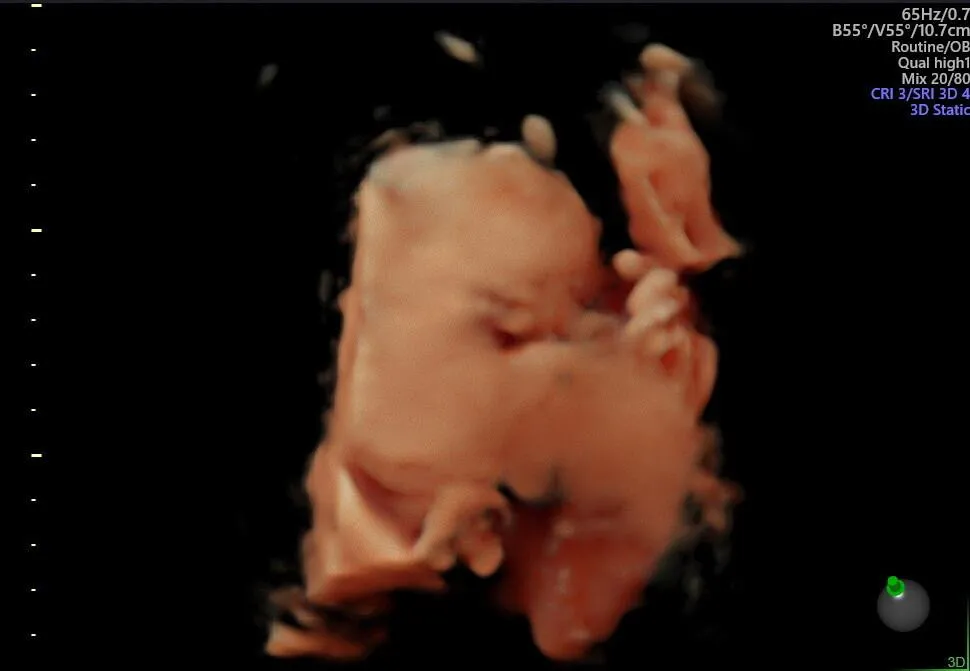Placenta
