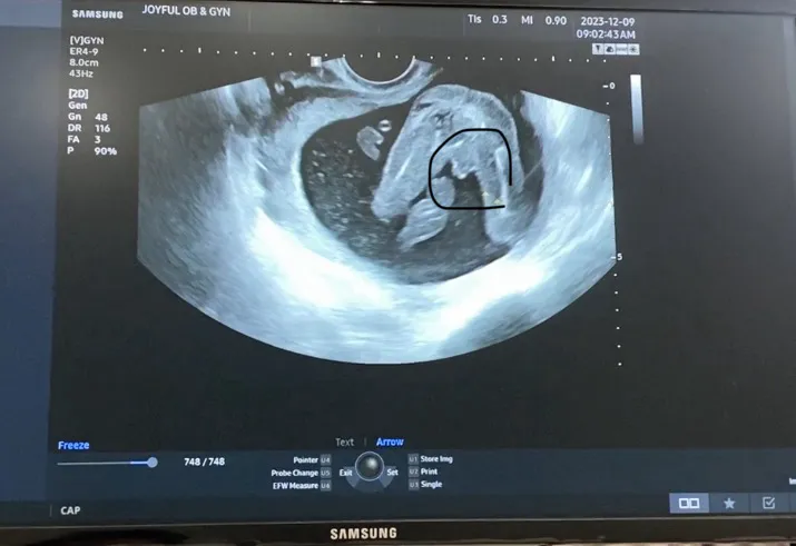 16주 5일인데 아들이래요 👶