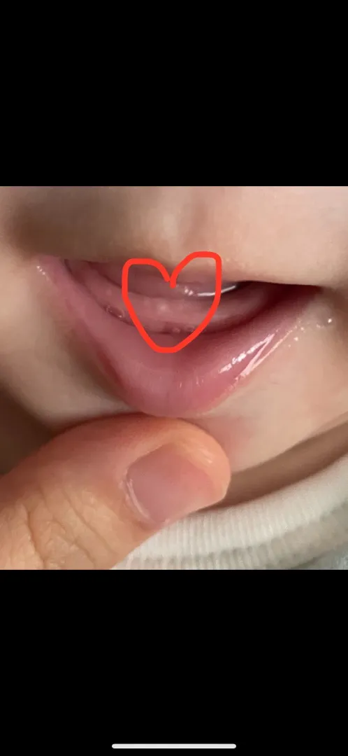 140일 아기에요! 이가 나려는 걸까요?