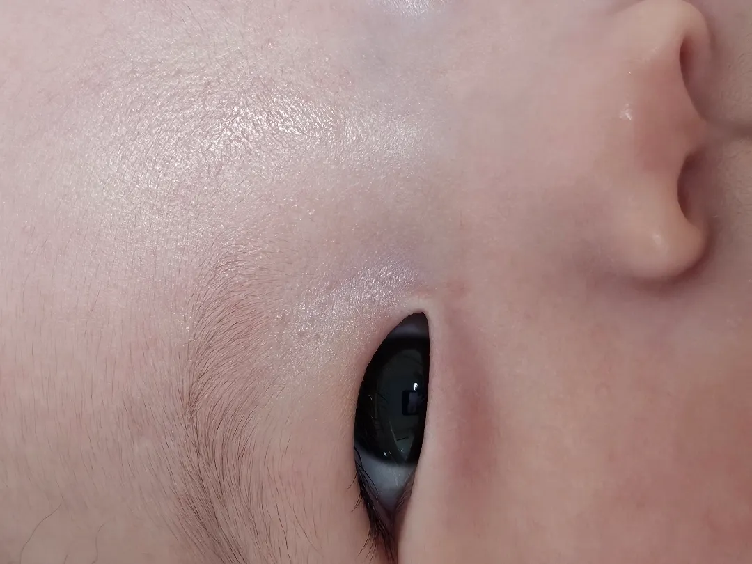 6개월아기 얼굴 봐주세요 ㅜㅠ