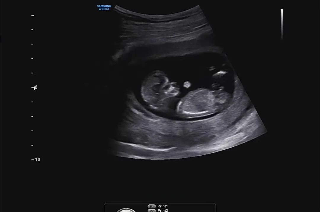 12주 1일 각도법 부탁드려요ㅠㅠ