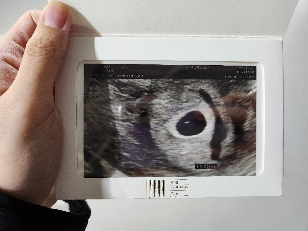 드디어 아기집을 확인하고 왔어요🥹