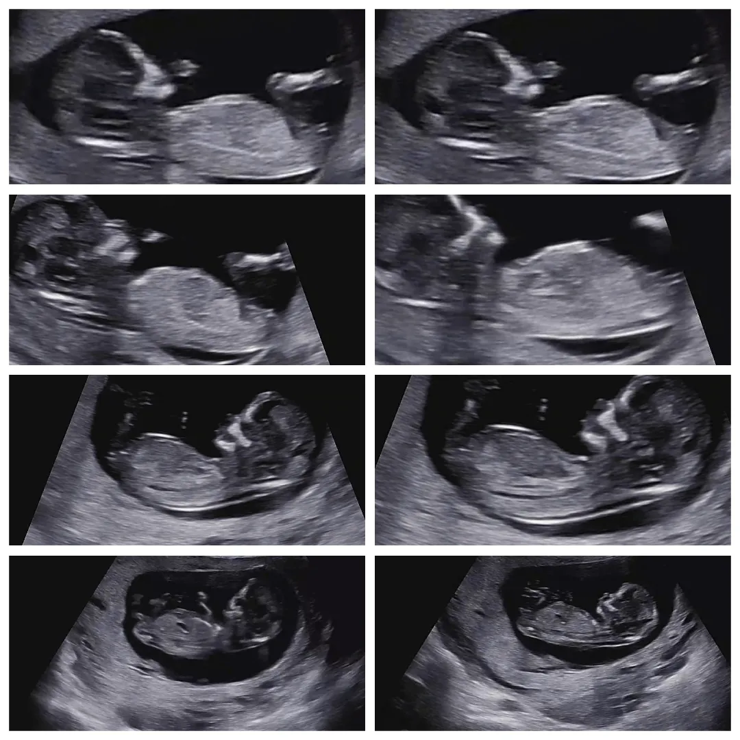12주 쌍둥이 초음파 같이 봐주실분♡