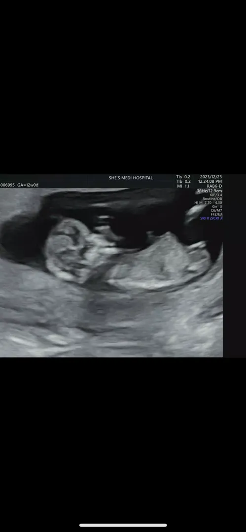 12주 각도법 저도 궁금해서 올려봅니당👶🏻