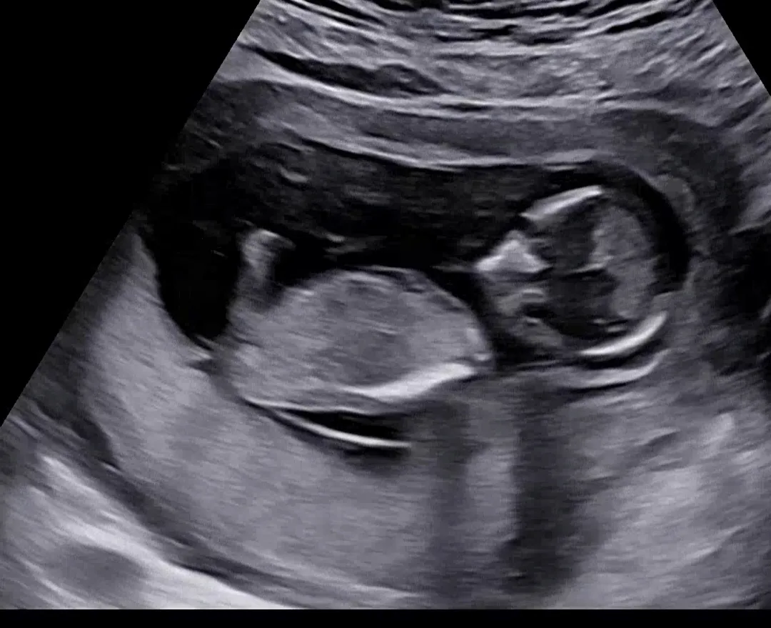 12주6일 각도법 알수있을까용?