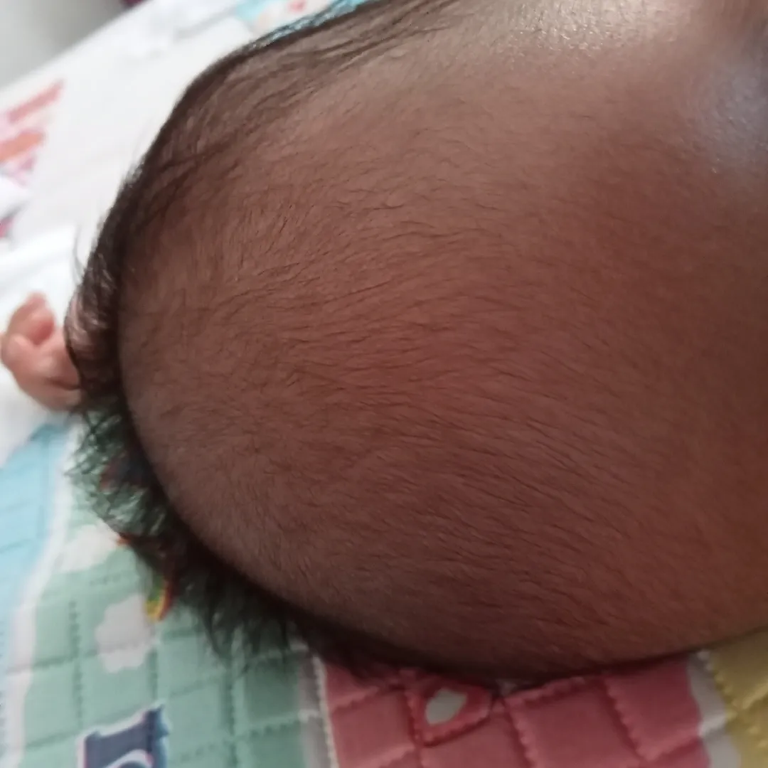 Rambut bayi