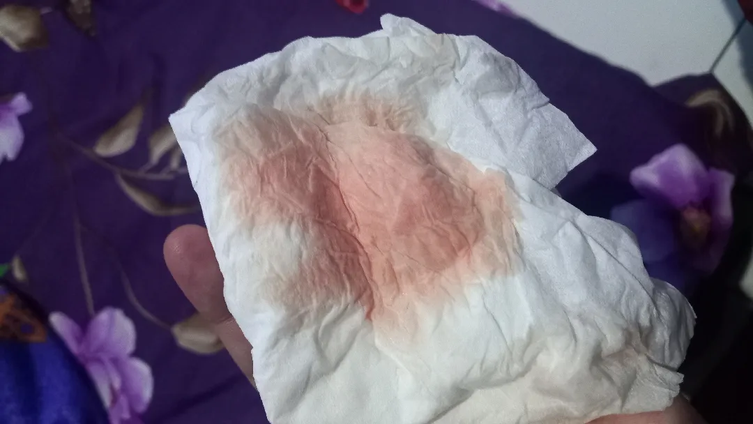 Keluar cairan merah muda