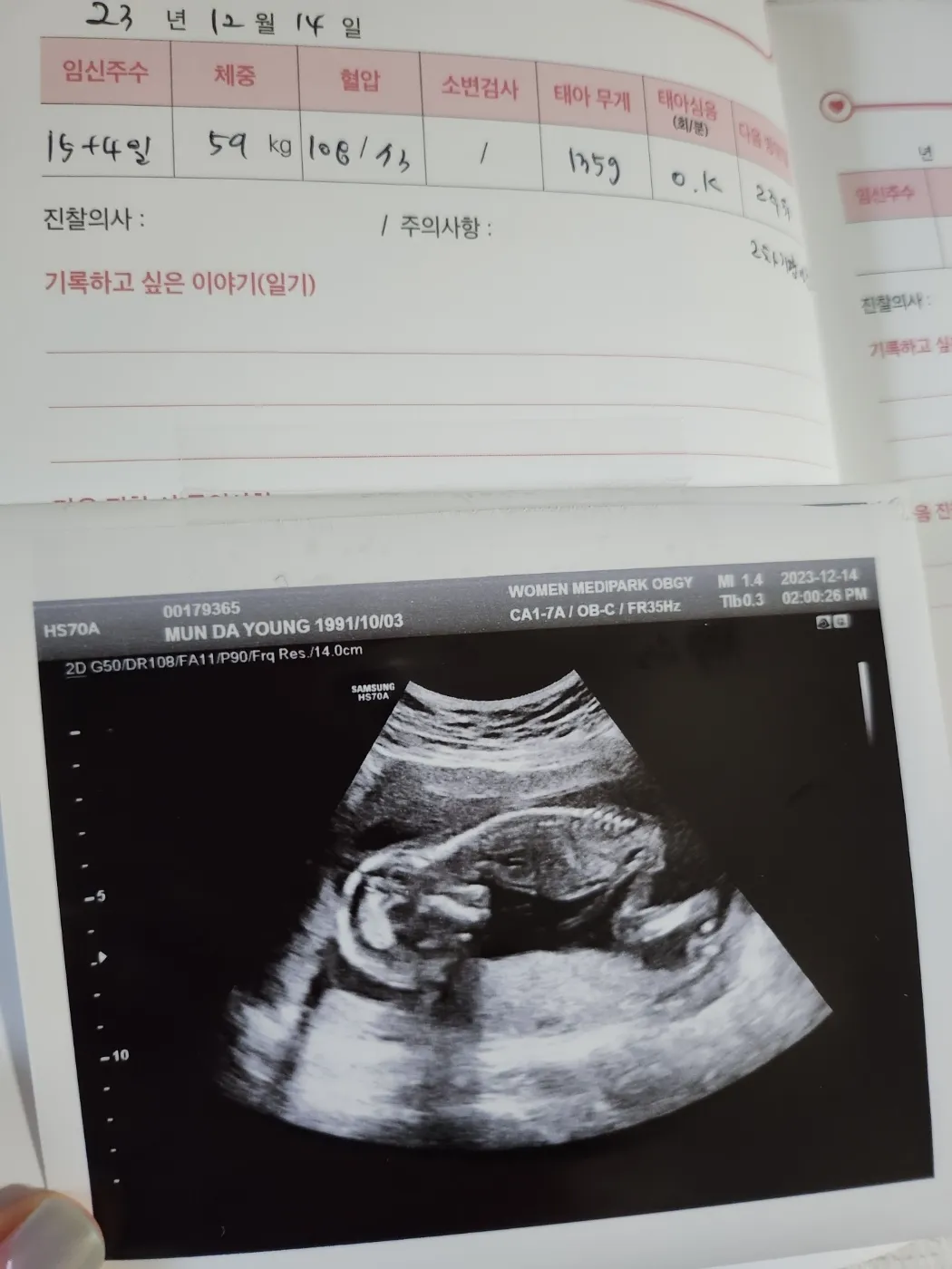 15주아기 성별을꽁꽁숨기네요ㅎㅎ