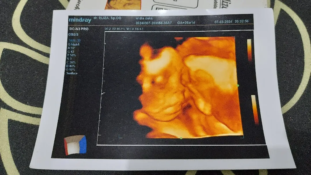 Bayi Mungilku❤️