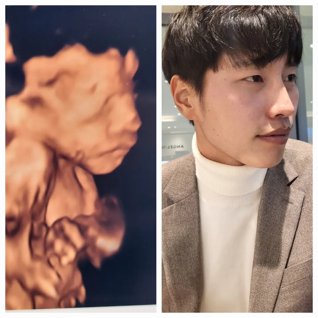 아빠코