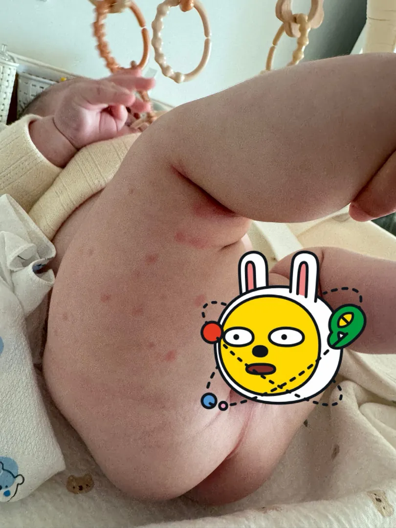 아기 피부 ㅠㅠ